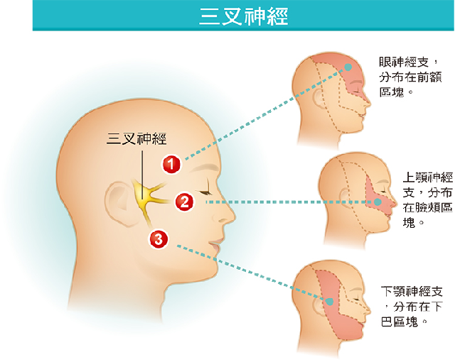 三叉神经痛最新治疗策略与方案